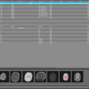 MedINRIA freeware screenshot